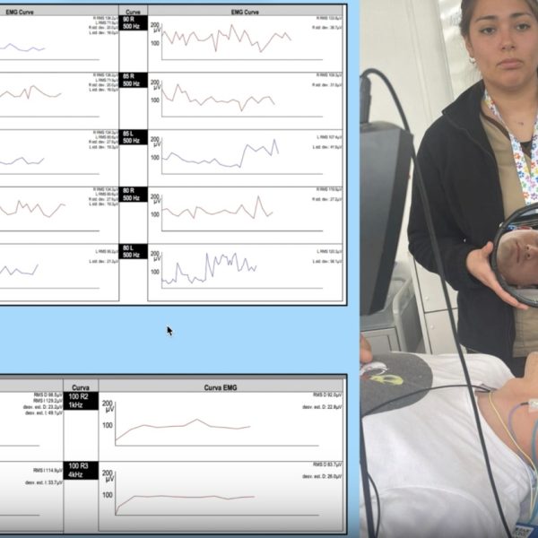 Académico UACh participó en el curso Clínica Otoneurologica…
