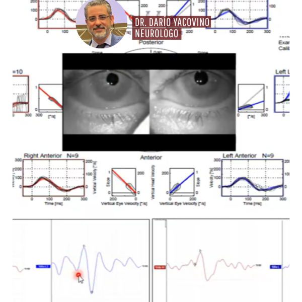 DICTAN CLASE MAGISTRAL SOBRE NEUROPATÍA VESTIBULAR AGUDA EN&hellip;