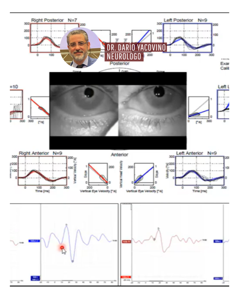 DICTAN CLASE MAGISTRAL SOBRE NEUROPATÍA VESTIBULAR AGUDA EN LA UACH SEDE PUERTO MONTT